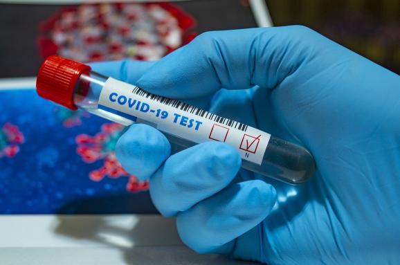 У 82 закарпатців за минулу добу діагностовано коронавірусну хворобу 