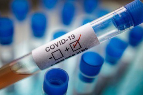 Кількість виявлених хворих на COVID-19 на Закарпатті стабілізувалась
