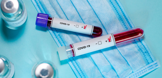 У лікаря та медсестри Ужгородської міської лікарні підтверджено коронавірус 