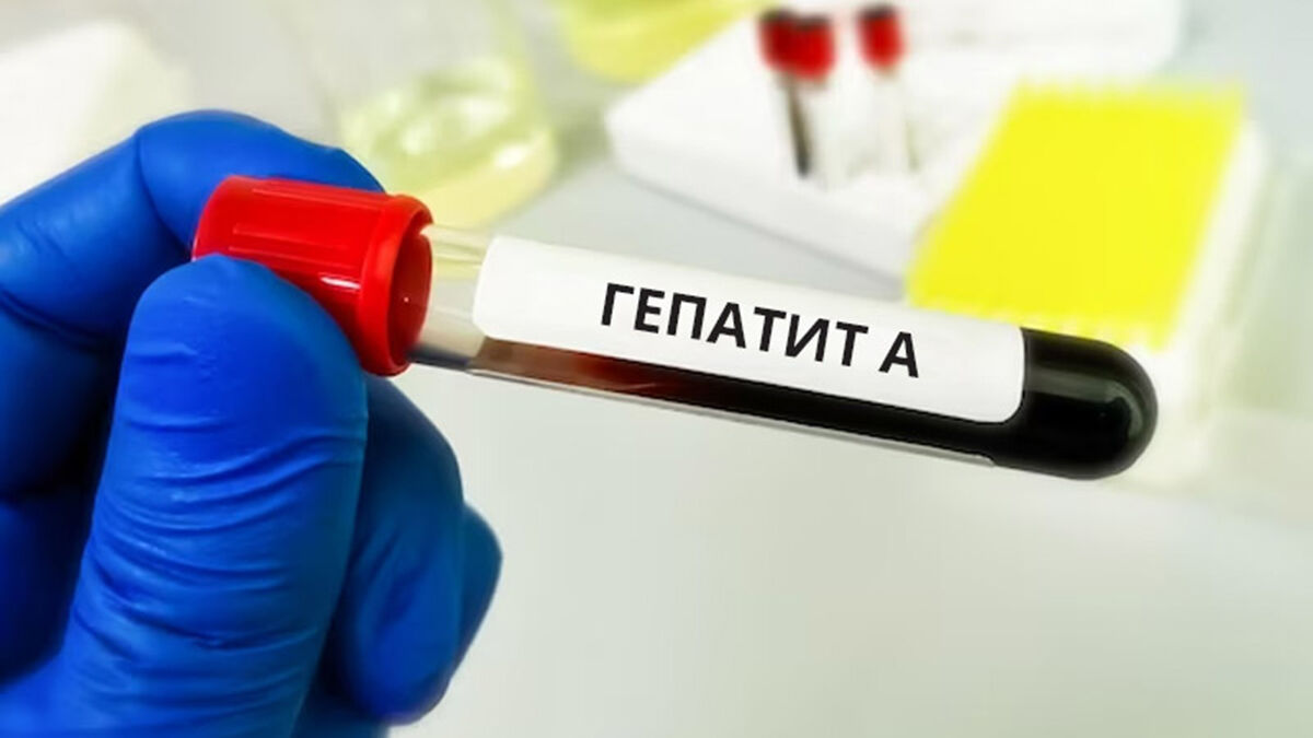 Гепатит А