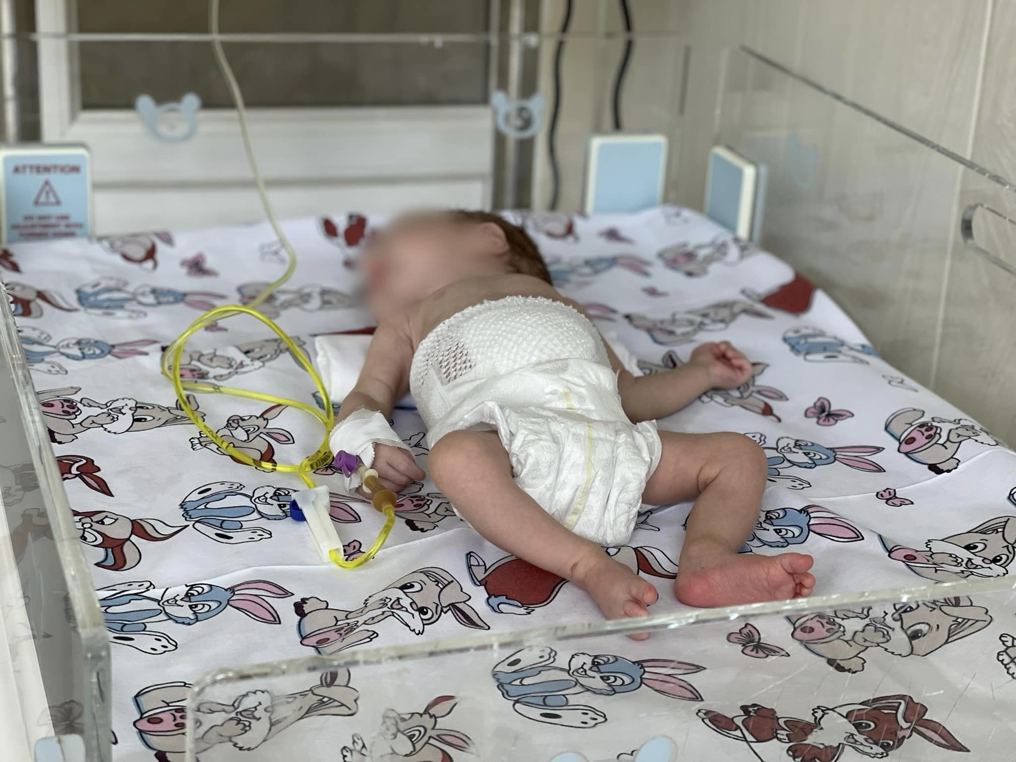 Хлопчик народився з вадою 