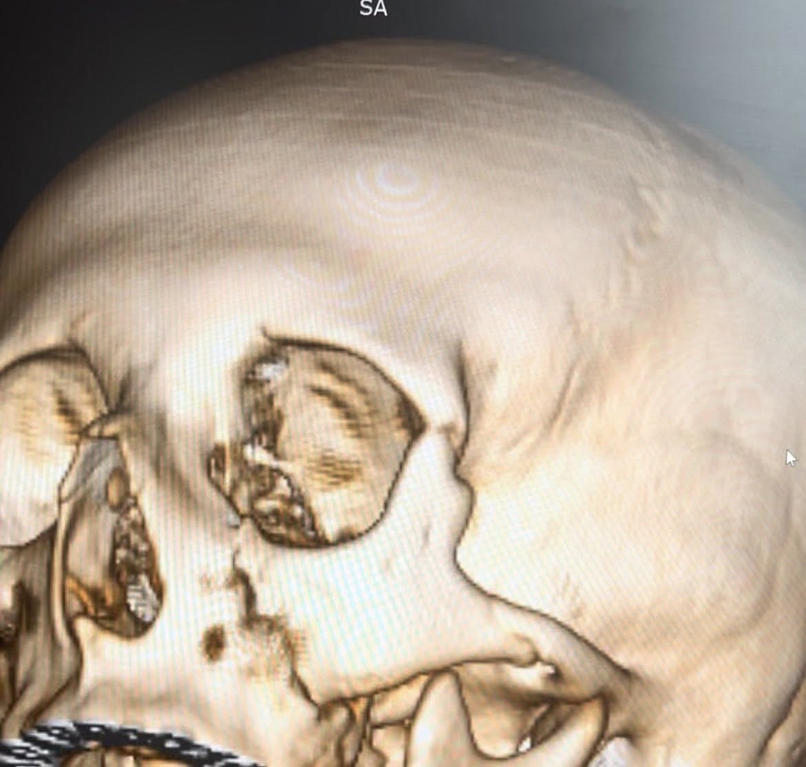 Пошкодження