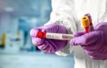   За добу ще у 23 закарпатців підтверджено коронавірус