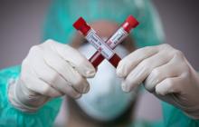 Ще 82 закарпатцям діагностували COVID-19