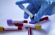 У 100 ужгородців виявили COVID-19