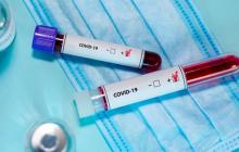 У лікаря та медсестри Ужгородської міської лікарні підтверджено коронавірус 